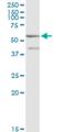 NADP-dependent malic enzyme antibody, H00004199-M01, Novus Biologicals, Western Blot image 