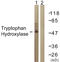 Tryptophan Hydroxylase 1 antibody, LS-C117936, Lifespan Biosciences, Western Blot image 
