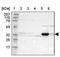 Dehydrogenase/Reductase 1 antibody, PA5-51420, Invitrogen Antibodies, Western Blot image 