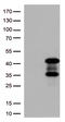Protein Kinase AMP-Activated Non-Catalytic Subunit Beta 1 antibody, TA813121S, Origene, Western Blot image 