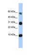 Fatty Acid Binding Protein 4 antibody, orb329754, Biorbyt, Western Blot image 