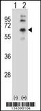 Cholinergic Receptor Muscarinic 2 antibody, 57-722, ProSci, Western Blot image 