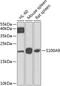 S100 Calcium Binding Protein A9 antibody, 23-938, ProSci, Western Blot image 