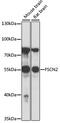 Fascin Actin-Bundling Protein 2, Retinal antibody, 16-636, ProSci, Western Blot image 