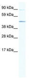 ECSIT Signalling Integrator antibody, TA342303, Origene, Western Blot image 