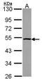 Proteasome 26S Subunit, ATPase 4 antibody, NBP2-20581, Novus Biologicals, Western Blot image 