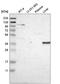 Galectin 8 antibody, NBP2-55285, Novus Biologicals, Western Blot image 