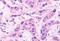 Cadherin EGF LAG Seven-Pass G-Type Receptor 2 antibody, NLS1943, Novus Biologicals, Immunohistochemistry frozen image 