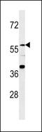 Zinc Finger Protein 776 antibody, LS-C157509, Lifespan Biosciences, Western Blot image 