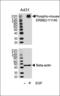 ERBB2 antibody, MBS9210880, MyBioSource, Western Blot image 