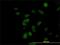 CDK5 Regulatory Subunit Associated Protein 3 antibody, H00080279-M01, Novus Biologicals, Immunocytochemistry image 