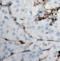 Collagen Type XVIII Alpha 1 Chain antibody, orb393249, Biorbyt, Immunohistochemistry paraffin image 