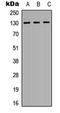 EPH Receptor A3 antibody, LS-C358975, Lifespan Biosciences, Western Blot image 