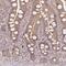 Proprotein Convertase Subtilisin/Kexin Type 2 antibody, NBP2-48942, Novus Biologicals, Immunohistochemistry frozen image 