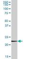 Clathrin Light Chain B antibody, H00001212-D01P, Novus Biologicals, Western Blot image 