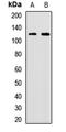 Ubiquitin Like Modifier Activating Enzyme 6 antibody, LS-C668792, Lifespan Biosciences, Western Blot image 