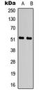Activating Transcription Factor 2 antibody, LS-C358915, Lifespan Biosciences, Western Blot image 