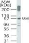 TNF Receptor Superfamily Member 11a antibody, PA1-41389, Invitrogen Antibodies, Western Blot image 