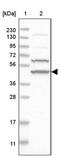 Adenylosuccinate Synthase antibody, PA5-55070, Invitrogen Antibodies, Western Blot image 