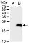 LIM Domain Only 4 antibody, NBP2-43538, Novus Biologicals, Western Blot image 