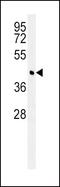 Branched Chain Amino Acid Transaminase 1 antibody, PA5-23656, Invitrogen Antibodies, Western Blot image 