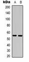 Acyl-CoA Thioesterase 13 antibody, orb75235, Biorbyt, Western Blot image 