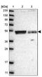 Protein Tyrosine Phosphatase Non-Receptor Type 5 antibody, NBP1-87186, Novus Biologicals, Western Blot image 