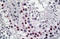 TSPY Like 2 antibody, MBS422252, MyBioSource, Immunohistochemistry frozen image 