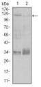 Integrin Subunit Beta 1 antibody, GTX60564, GeneTex, Western Blot image 
