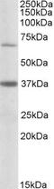 Carnitine Palmitoyltransferase 2 antibody, PA5-19223, Invitrogen Antibodies, Western Blot image 