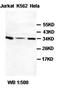 Protein Activator Of Interferon Induced Protein Kinase EIF2AK2 antibody, orb77444, Biorbyt, Western Blot image 