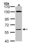 Glycerol Kinase antibody, PA5-28576, Invitrogen Antibodies, Western Blot image 