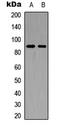 Fibroblast Growth Factor Receptor 4 antibody, LS-C354367, Lifespan Biosciences, Western Blot image 