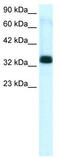 TIA1 Cytotoxic Granule Associated RNA Binding Protein Like 1 antibody, TA330340, Origene, Western Blot image 