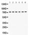 LIM Domain Kinase 2 antibody, PB9717, Boster Biological Technology, Western Blot image 