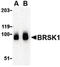 BR Serine/Threonine Kinase 1 antibody, LS-B180, Lifespan Biosciences, Western Blot image 