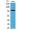 Tumor Protein P73 antibody, LS-C387108, Lifespan Biosciences, Western Blot image 