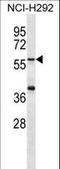 Matrilin 1 antibody, LS-C164049, Lifespan Biosciences, Western Blot image 