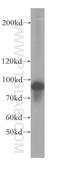 TBC1 Domain Family Member 5 antibody, 17078-1-AP, Proteintech Group, Western Blot image 