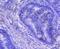 Cyclin A2 antibody, NBP2-67813, Novus Biologicals, Immunohistochemistry paraffin image 