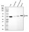 Tumor Associated Calcium Signal Transducer 2 antibody, A03569-2, Boster Biological Technology, Western Blot image 