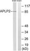 Amyloid-like protein 2 antibody, TA313463, Origene, Western Blot image 