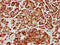 Carbohydrate Sulfotransferase 14 antibody, CSB-PA839851LA01HU, Cusabio, Immunohistochemistry paraffin image 