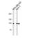 Angiotensin I Converting Enzyme 2 antibody, abx034955, Abbexa, Western Blot image 