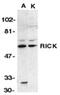 Receptor Interacting Serine/Threonine Kinase 2 antibody, ADI-AAP-460-E, Enzo Life Sciences, Western Blot image 