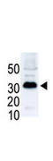 Snail Family Transcriptional Repressor 1 antibody, AP11932PU-N, Origene, Western Blot image 