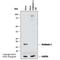 Stathmin 1 antibody, NBP1-76798, Novus Biologicals, Western Blot image 