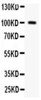 Coagulation Factor II, Thrombin antibody, PA2059, Boster Biological Technology, Western Blot image 