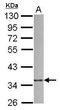 Actin Related Protein 2/3 Complex Subunit 1B antibody, PA5-34845, Invitrogen Antibodies, Western Blot image 