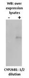 Cytochrome P450 Family 26 Subfamily B Member 1 antibody, NBP2-50195, Novus Biologicals, Western Blot image 